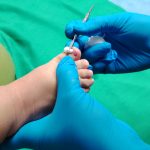 podologia infantil